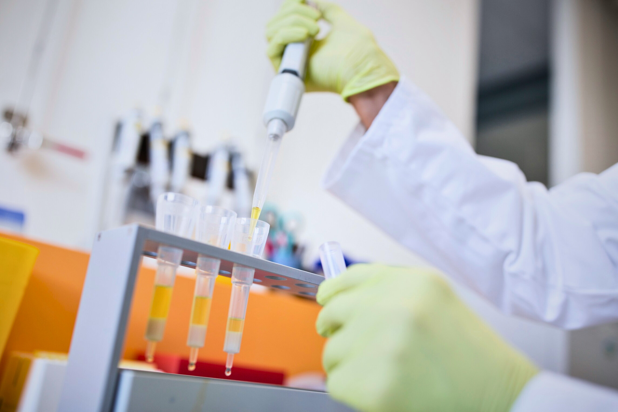solid phase extraction